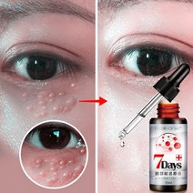 아이크림 주름지우개 최신 안티 붓기 제거 주름 눈 혈청 제거 지방 과립 다크 서클 안티 에이징 모이스춰, 아이 세럼