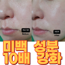 약국용 특허 기미잡티 검버섯크림/기미지우개 검버섯제거연고 검버섯제거크림 검버섯앰플 기능성인증 기미주근깨잡아주는 반점제거 멜라닌 색소침착, 약국전용 검버섯 크림 1+1, 2개