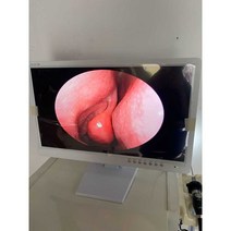 의료용 모니터 진단 내시경 디스플레이 CT 24인치