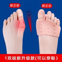 발가락교정기 무지외반증교정기 112406 발가락 교정기 엄지 외반 큰 여성 발가락 외반 모지 교정 큰 발 뼈 발 유형 남성과 여성을위한 발가락 분리기, 사이즈_10