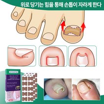 DRYMARTINE 내성발톱교정테이프 발톱 테이프 200pcs, 600개
