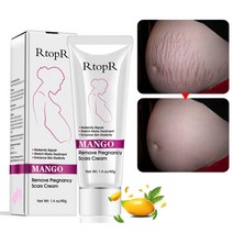 YAPOGI 스트레치 마크 출산 수리 안티 튼살크림 망고 임신 흉터 제거 여드름 크림, 1개