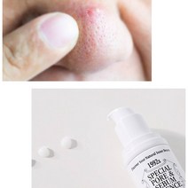 남자 넓어진 넓은 모공 축소 코주변 각질 줄이는법 수분부족지성 수렴화장수 입술밑 피지