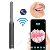 Smabat 무선 WiFi 구강 카메라 내시경 구강 치과 내시경 와이파이 화소 100만 1080P 6 LED 라이트 화이트 블랙 그린 블루, 1개