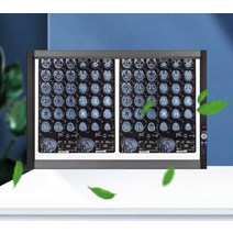 X-ray LED 박스 라이트 디지털 패드 보드 필름 드로잉, 터치스크린 디밍 이중 연결