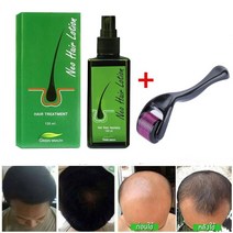 헤어에센스 모발강화 헤어오일 네오 헤어 로션 120ml 에센스 제조 탈모 방지 두피 트리트먼트 남성 및 여, 01 as the picture shows