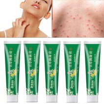 5P 식물 추출 모낭염 가려움증 지루성피부염 연고, 5개