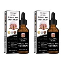 50ml 특별 1+1+1 발톱무좀 조갑사상균증 개선 에센 EELHOE