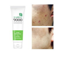 1+1 에스알픽 트러블 자국 각질 모공수축 티트리폭탄 폼클렌징 120ml, 2세트