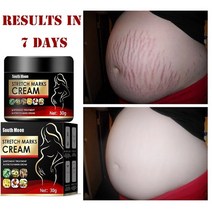 천연 스트레치 마크 제거 크림 산후 비만 제거 임산부 리페어 안티 에이징 안티 링클 퍼밍 바디 크림