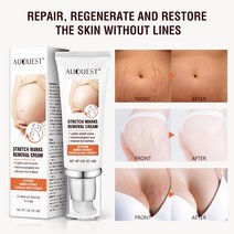 CAICHEN 임산부크림 Remove Pregnancy Scars Acne Cream Stretch Mark Treatment Maternity Repair Anti-Aging, 4개 2개