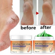 갈라진 힐 밤 크림 거친 건조 및 손/발 스킨 케어 천연 에센스, [03] 50g
