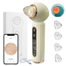 블랙헤드 제거기 피지 흡입기 피부케어 비주얼 블랙 헤드 리무버 진공 모공 청소기 여드름, 시각적 모양-w, 협력사