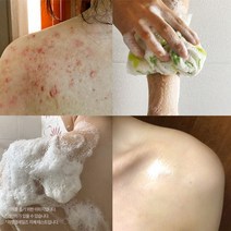 라벨영화장품 [라벨영] 쇼킹고약한바디비누, 쇼킹고약한바디비누 1개