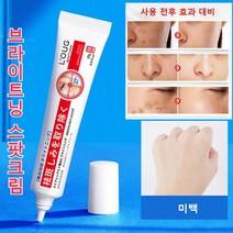 [한시적 할인1+1] 브라이트닝 스팟크림 반점 제거 연고 20g, 20g*10