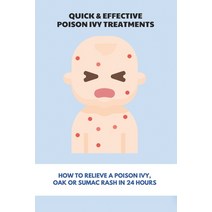 Quick & Effective Poison Ivy Treatments: How To Relieve A Poison Ivy Oak Or Sumac Rash In 24 Hours:... Paperback, Independently Published