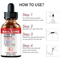 조갑사상균증 손톱 곰팡이 치료 풋 케어 세럼 발 수리 제거 감염 방지 Paronica 백선 젤, [03] 30ml