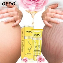 장미 스트레치 마크 크림 영양 주름 방지 임산부 피부 수리 비만 바디 케어 40g