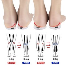 오다리교정 X다리 교정 교정 슬리퍼 교정 운동 교정기 오다리교정 X다리교정, S 코드(26-34)