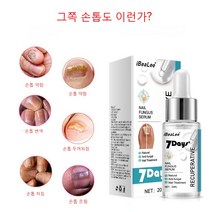 iBeaLee 발톱무좀치료 발톱 무좀약 20ml