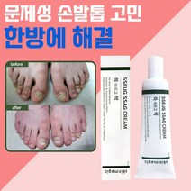 문제성 손발톱 케어 뒤꿈치 갈라짐 두꺼운 발톱 발각질 제거 연화제 치유크림 쓱싹크림 30ml 쓱싹크린풋 발비누 별도 구매 가능, 쓱싹크림 1개