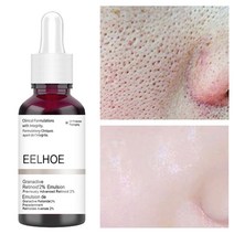 살리실산 수축 모공 세럼 과일 산 엑스 폴리 에이 팅 모이스춰 라이징 뉴 리쉬 스무스 모공 리페어 에센스 제품 스킨 케어, 한 개