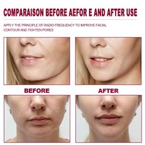 페이스 슬리밍 에센셜 오일 리프팅 퍼밍 마사지 주름 방지 V 모양 셰이퍼 페이셜 세럼 페이드 미세 라인 보, 한개옵션0