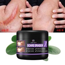 흉터제거연고 화상연고 수술흉터 제거 흉터 관리 흉터재생연고 흉터 연고, 50ml, 2개