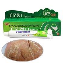 건선크림 아토피 피부습진 완화 크림 가려움방지 크림 보습제