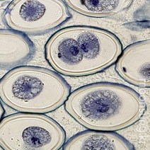 체세포분열 슬라이드표본(동물)