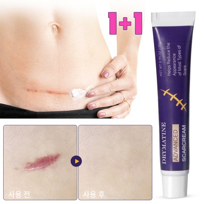 [당일배송] DRYMATINE 흉터연고 흉터제거연고 재생크림 상처흉터연고 여드름흉터 수술흉터 화상물집 흉터제거연고