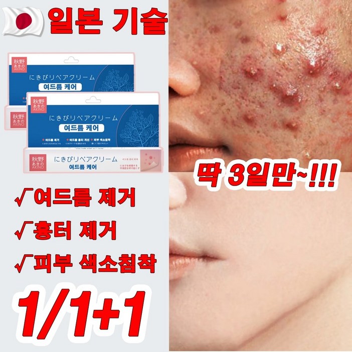 일본 1/1+1 자생크림 여드름 크림 여드름 흉터 제거 연고 여드름 케어 색소침착 선물 랜덤 증정