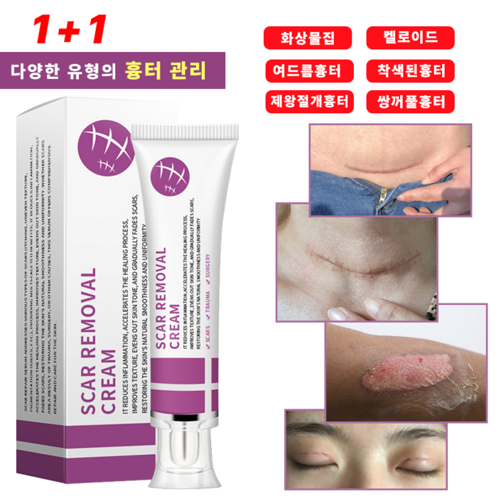 흉터연고 화상연고 상처연고 켈로이드 화상물집 여드름흉터 제왕절개흉터 피부흉터 착색된흉터 비후성 반흔 쌍꺼풀흉터, 30ml, 2개