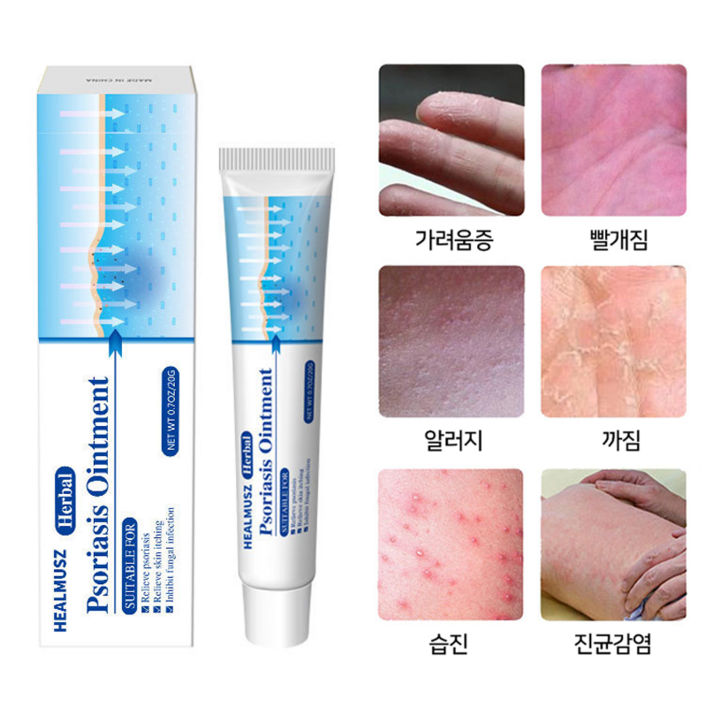 접촉성피부염 알러지 알레르기 피부연고 아토피상처 소양증 대상포진 백선연고 습진 A04 접촉성피부염 알러지 알레르기 피부연고 아토피상처 소양증 대상포진 백선연고 습진 A04