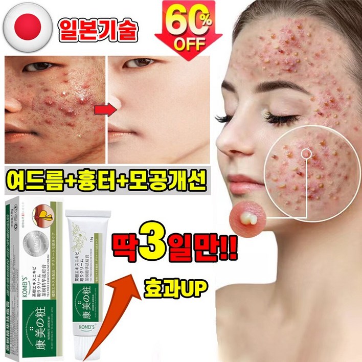 일본기술 여드름 연고 흉터 치료 제거 리페어 크림 피부 모공 진정 피지케어 크림