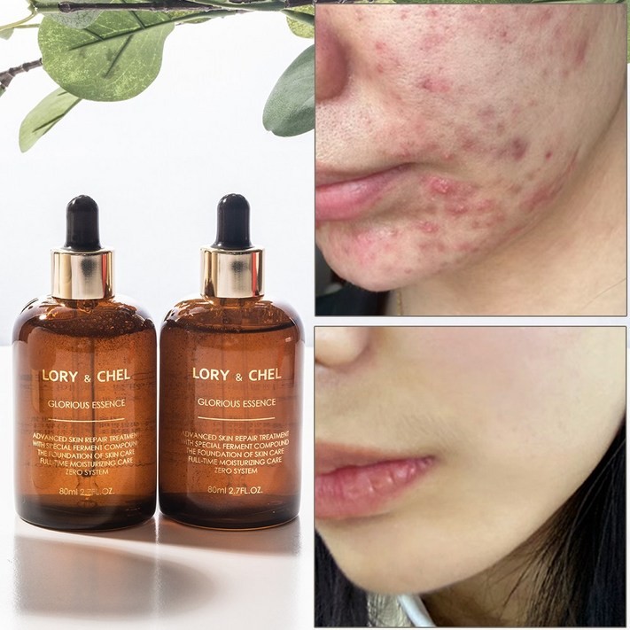 로리앤첼 글로리어스 에센스 앰플 세럼 80g, 80g, 2개 로리앤첼 글로리어스 에센스 앰플 세럼 80g, 80g, 2개
