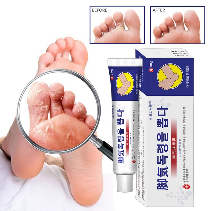 국내산당일배송 가려움증 완화 발냄새 제거 연고 피부인텐시브 연고 풋 리페어 크림, 1개, 20g, 1개입 국내산당일배송 가려움증 완화 발냄새 제거 연고 피부인텐시브 연고 풋 리페어 크림, 1개, 20g, 1개입