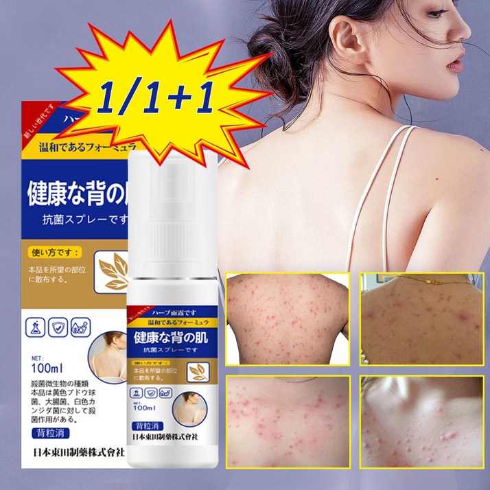 KORE LAN  1+1  바디여드름/등드름개선/가려움증을 빠르게 완화 /진드기 제거 /보디 스프레이